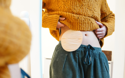 Ostomy Care: What Nurses Need to Know